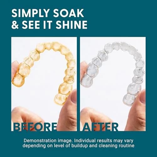 M3 Naturals Retainer & Denture Cleaning Kit with Bath Case, 92 Mint Tablets | Cleans Aligners, Mouthguards, and Dentures thumbnail 9