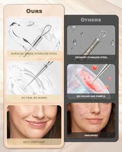SG Nekoo Professional Milia Removal Tool Kit with Tweezers & Case | Stainless Silver thumbnail 5