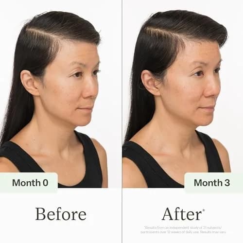 divi Scalp Serum | To Promote Fuller-Looking Hair with Peptides | 100 ml thumbnail 3