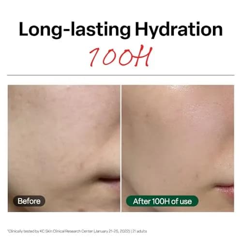 Dr.G R.E.D. Blemish Clear Soothing Face Cream 70ml (2.36 fl oz) | Lightweight Hydration for All Skin Types thumbnail 3