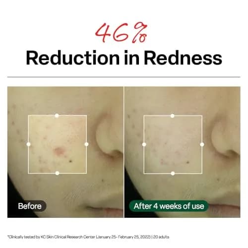 Dr.G R.E.D. Blemish Clear Soothing Face Cream 70ml (2.36 fl oz) | Lightweight Hydration for All Skin Types thumbnail 4