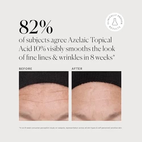 Naturium Azelaic Topical Acid 10% Serum 2 oz (59ml) | Balances Oil, Improves Tone with Niacinamide & Vitamin C thumbnail 4