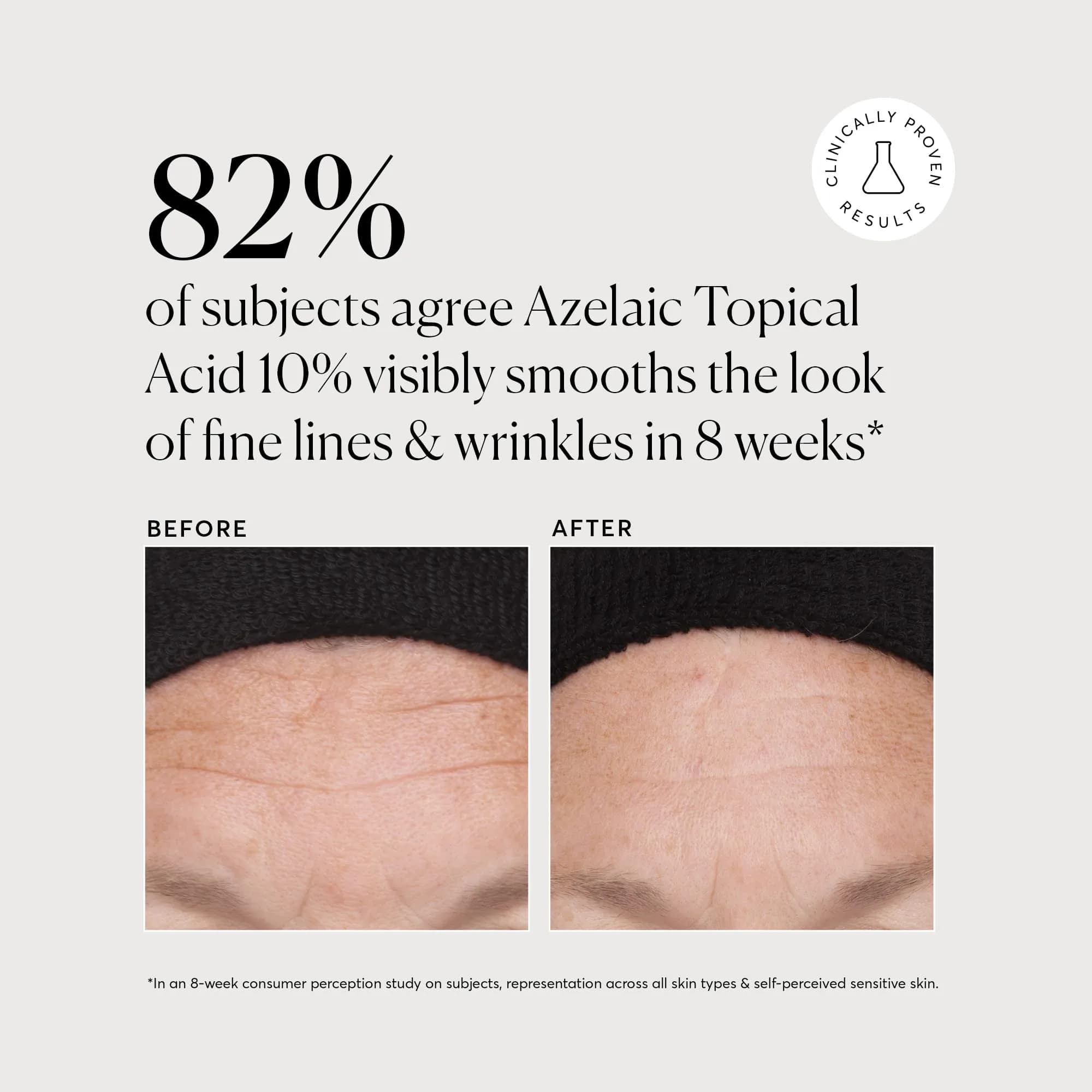 Naturium Azelaic Topical Acid 10% Serum 2 oz (59ml) | Balances Oil, Improves Tone with Niacinamide & Vitamin C - view 4