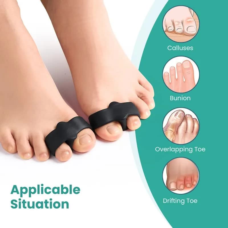 Welnove Pack of 12 Bunion Corrector Toe Separators with 2 Loops for Overlap Toe, Black | Soft Gel Toe Spacers for Pain Relief thumbnail 5