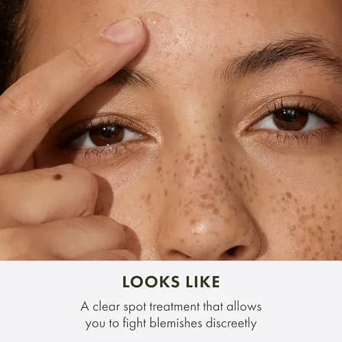 Origins Acne Spot Treatment 0.3 Fl Oz | Salicylic Acid for Pimples & Blackheads | Pack of 2 thumbnail 6