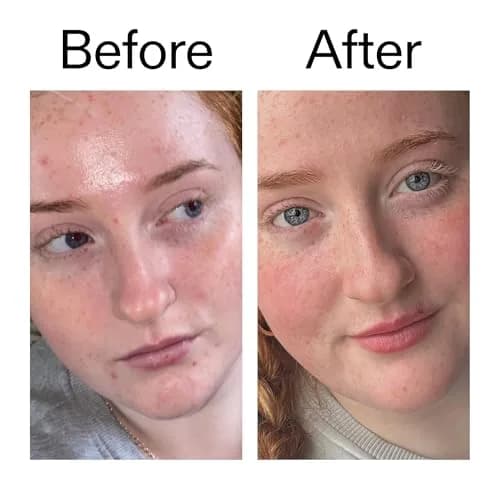 The INKEY List Vitamin B, C and E Moisturizer 1.7 oz | Hydrates, Brightens & Balances Skin thumbnail 6