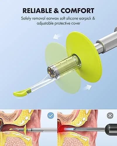 Anykit Digital Otoscope with Ear Wax Removal Tools for iPhone & Android, 2-Pack, Silver | HD Clear View Ear Camera thumbnail 4