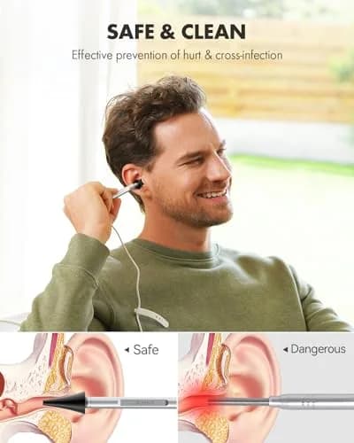 Anykit Digital Otoscope with Ear Wax Removal Tools for iPhone & Android, 2-Pack, Silver | HD Clear View Ear Camera thumbnail 3