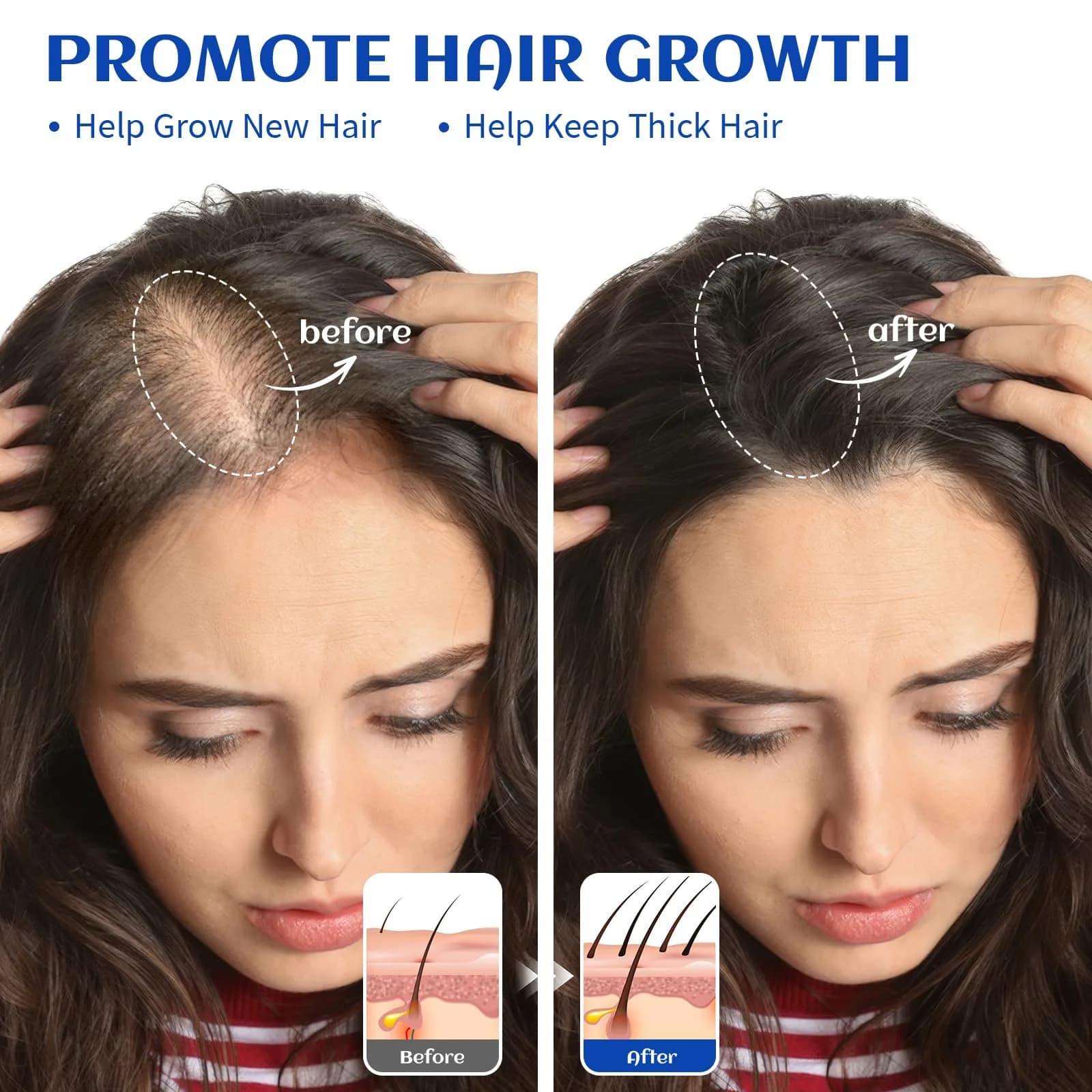 HIQILI Rosemary Essential Oil for Hair Growth, 1000ml (32 Fl Oz) | Pure Steam Distilled from Spain - view 2