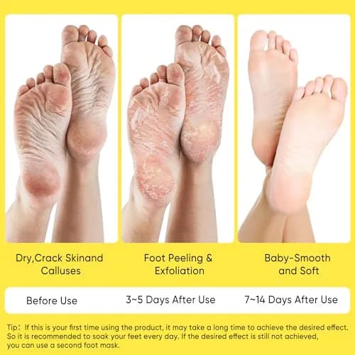 Berlaney Foot Peeling Mask for Dry Cracked Feet 3 Pairs | Exfoliating Peel with Shea Butter (60ml/2.03 Fl Oz) | Unisex thumbnail 4