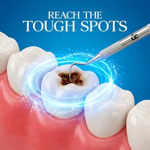 Utopia Care Professional Plaque Remover Tool 6.5 Inch Double-Sided Stainless Steel | Tartar Scraper for Teeth Cleaning thumbnail 5