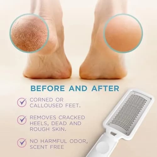 Lee Beauty Professional Foot File Scrubber for Cracked Heels & Dry Skin | Smooth Foot Pedicure Tool thumbnail 3