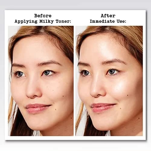 Thayers Milky Hydrating Face Toner with Snow Mushroom, Hyaluronic Acid & Elderflower | Alcohol-Free Sensitive Skin Care | 3 Fl Oz Pack of 5 thumbnail 5