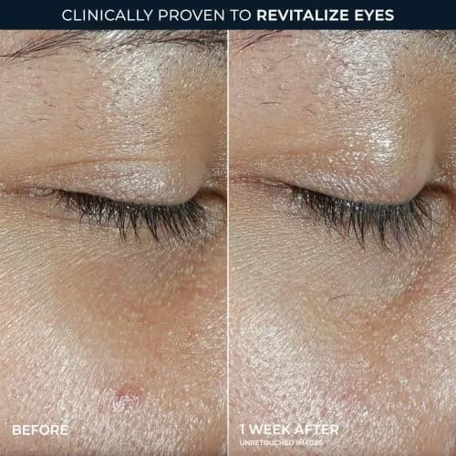 RoC Multi Correxion Revive + Glow Vitamin C Eye Balm Stick 0.14 oz (3.97g) | Clinically Proven for Dark Circles & Puffiness thumbnail 5