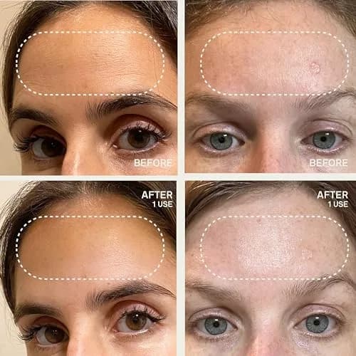Dermaclara Forehead Patch - Reusable Silicone Wrinkle Patches for Face Overnight | 1 Count thumbnail 5