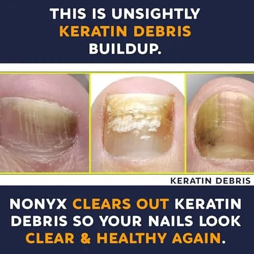 NONYX Fungal Nail Clarifying Gel (8 Fl Oz / 237ml) | Clinically Proven for Discolored, Thick, Brittle, Yellow, Lifted Nails thumbnail 7