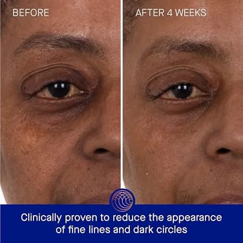 Augustinus Bader The Eye Patches 6 Pack | Hydrating & Anti-Aging Hydrogel Patches for Dark Circles thumbnail 3