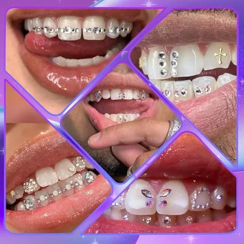 Loeland Tooth Gem Kit, DIY Crystals Teeth Jewelry Kit, Tooth Gems Starter Set | Safe, Durable & Easy to Use thumbnail 6