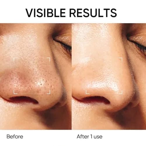 SKINTIFIC Deep Pore Cleansing Blackhead Remover Face Mask Stick 40g (1.41 fl.oz) | Cleanses Pores & Exfoliates thumbnail 4