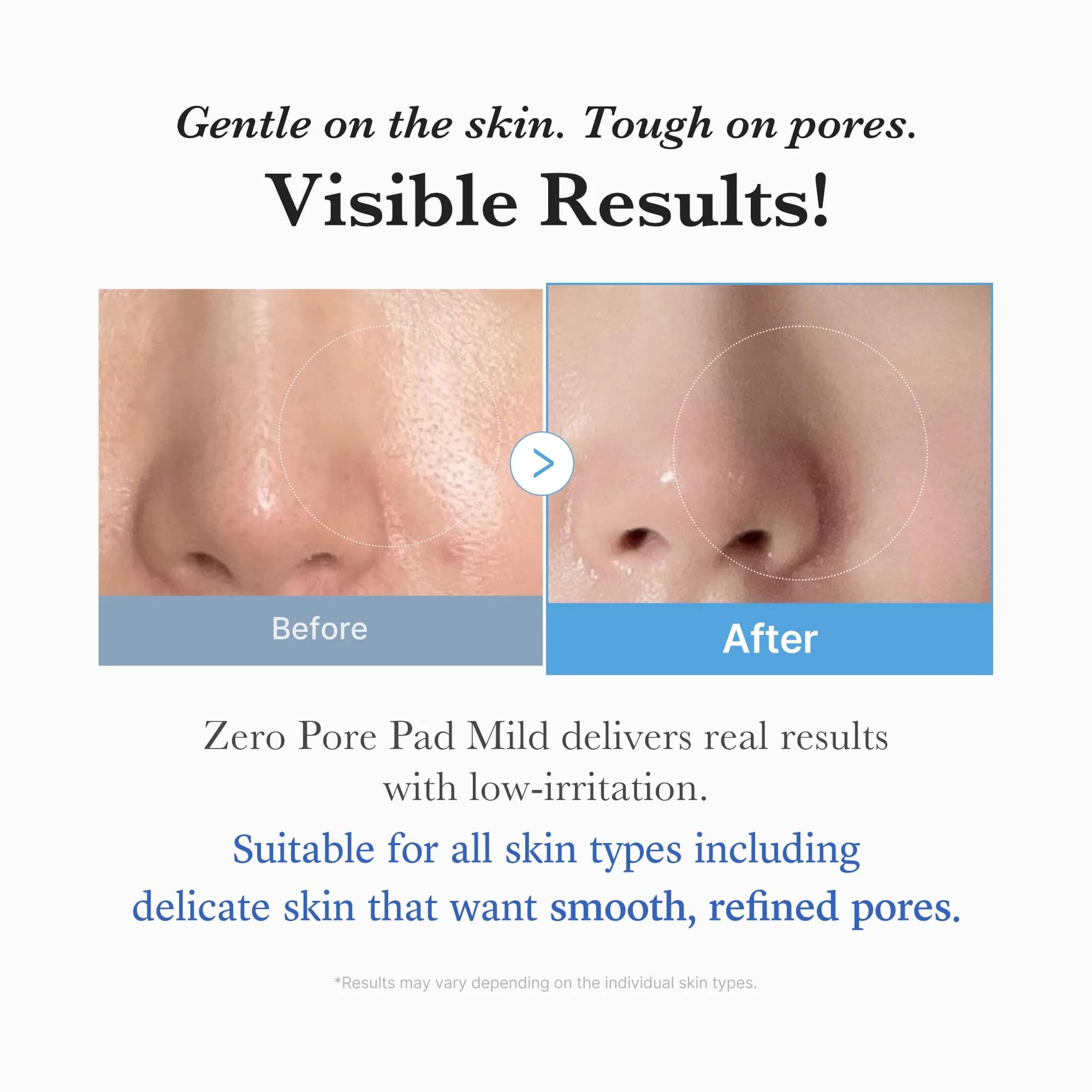 medicube Zero Pore Pads Mild 2.0 Toner Pads 70 Count (Pack of 1) | Gentle Exfoliation for Pores & Blackheads - view 5