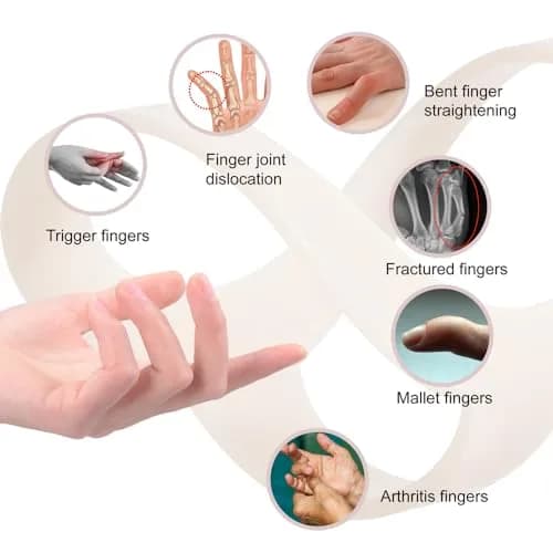 UAKIKAU Oval Finger Splint 8 pcs, Medium (1.5-2.7 Inches) | Supports Mallet, Trigger, Arthritis Fingers thumbnail 7