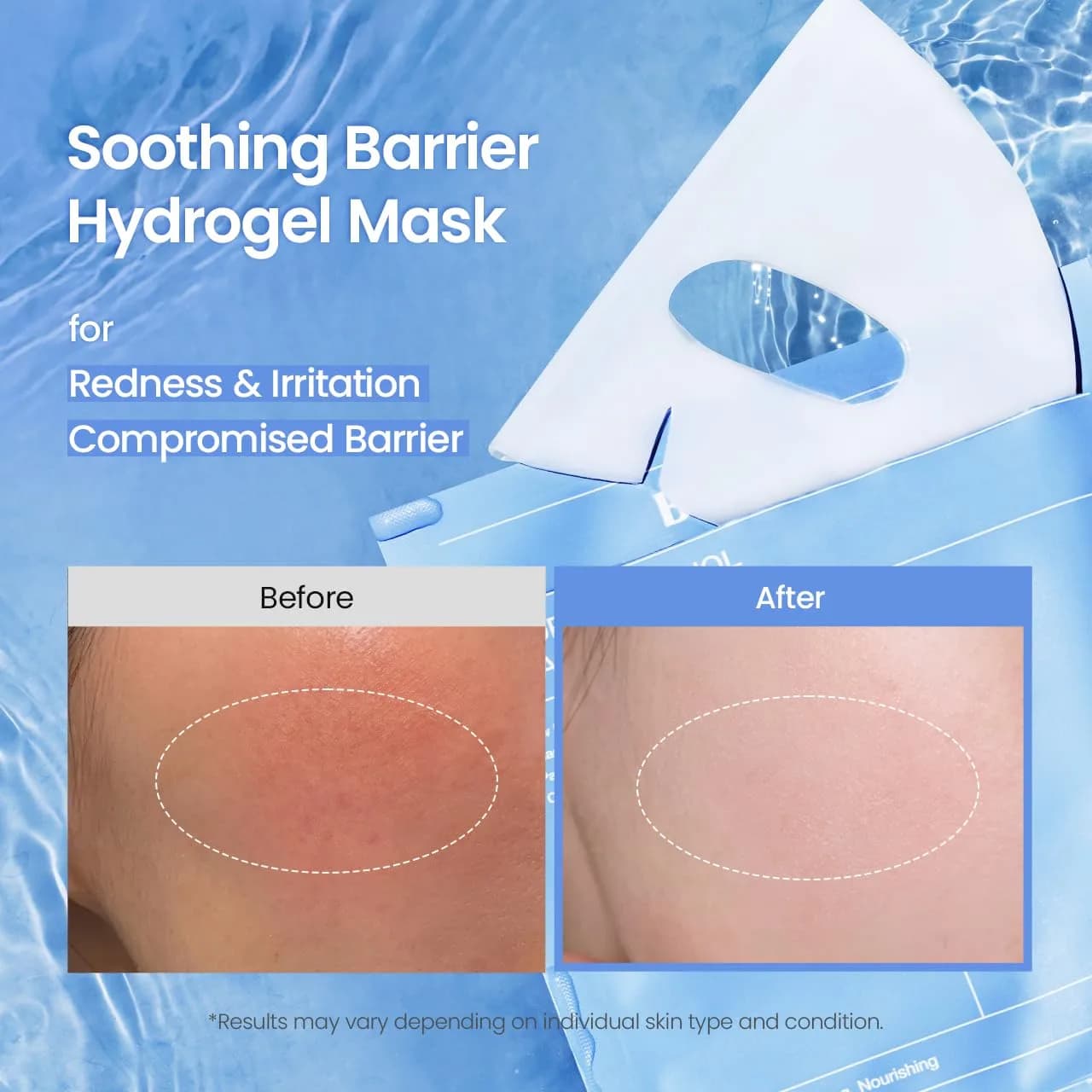 BIODANCE Hydro Cera-nol Real Deep Mask 34g (1.19oz) 4ea | Hydrating Overnight Hydrogel Face Mask for Redness Relief - view 3