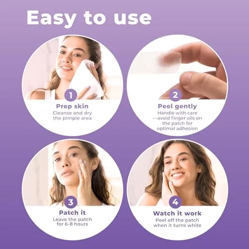 PatchRx Large Pimple Patches 20 Count | Hydrocolloid Acne Patch for Face & Body thumbnail 4
