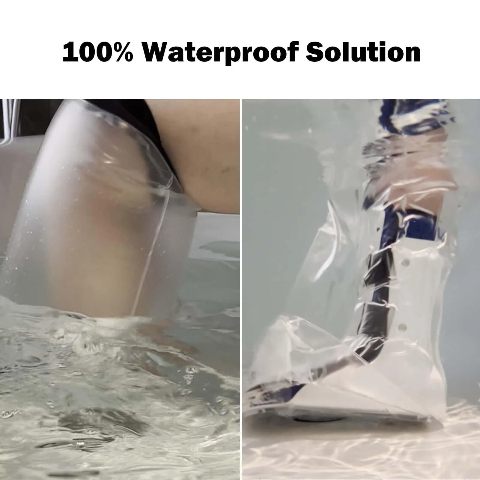 CIVJET Waterproof Leg Cast Cover for Showering, Opening Diameter 7.9" (200mm) | FDA Approved Professional Healthcare - view 2