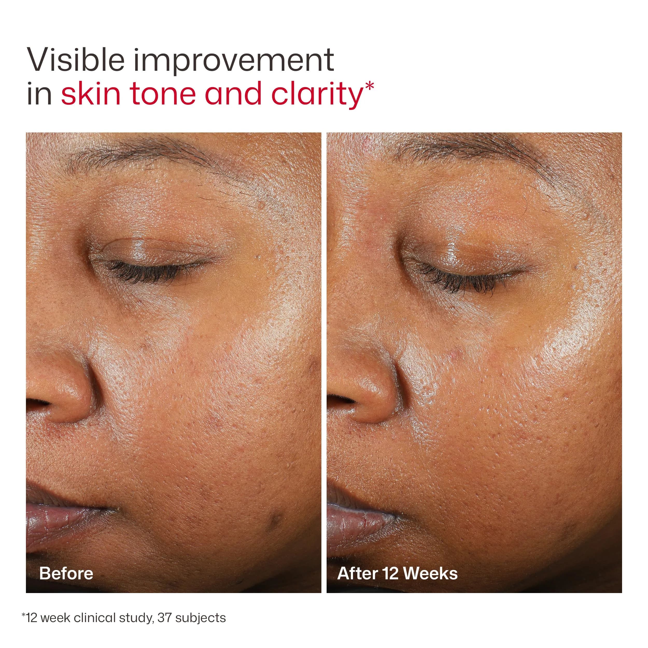 EltaMD UV Clear Deep Tinted Face Sunscreen SPF 46, 1.7 oz Pump | Broad Spectrum Protection for Deep Skin Tones - view 9