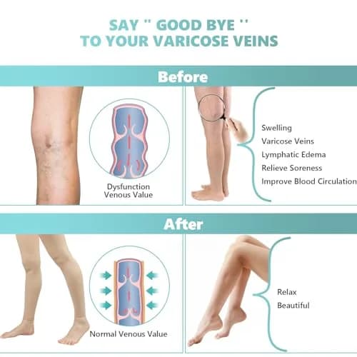 Laubawck Medical Compression Pantyhose for Women, 20-30 mmHg Graduated Support Tights | FDA Approved OTC Device thumbnail 4