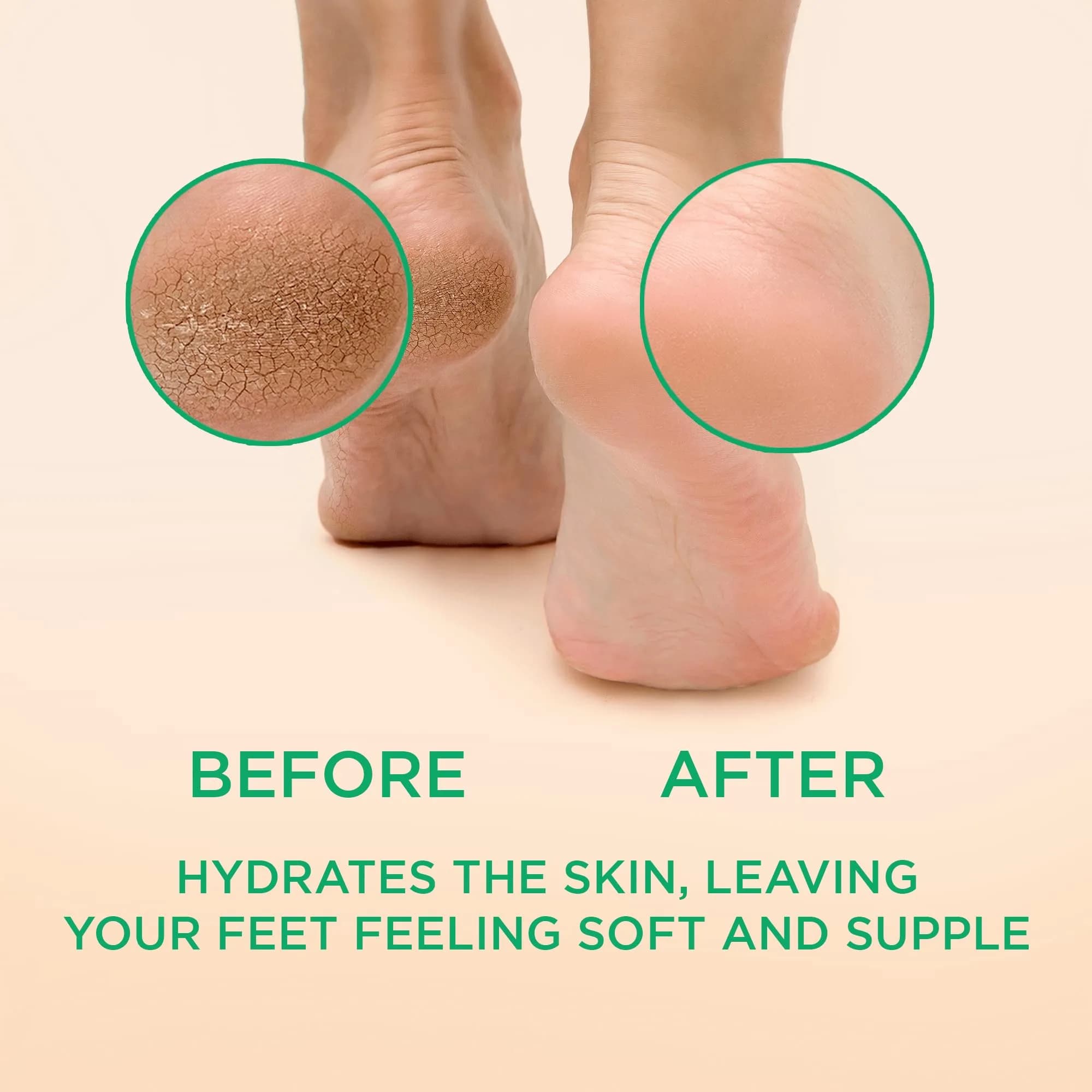 Lee Beauty Professional Peppermint Callus Remover Gel 2x6oz (12oz Total) | Smoother, Softer Feet in Minutes thumbnail 2