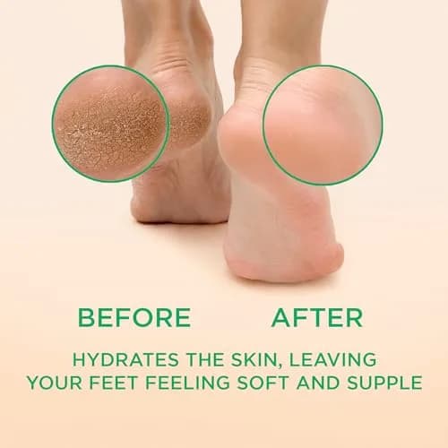 Lee Beauty Professional Peppermint Callus Remover Gel 2x6oz (12oz Total) | Smoother, Softer Feet in Minutes thumbnail 2