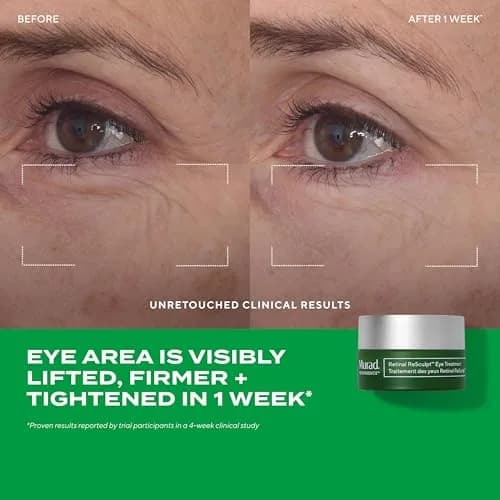 Murad Retinal Trial Kit - Encapsulated Retinal - 2-pc Set | Anti-Aging for Lines & Wrinkles thumbnail 4