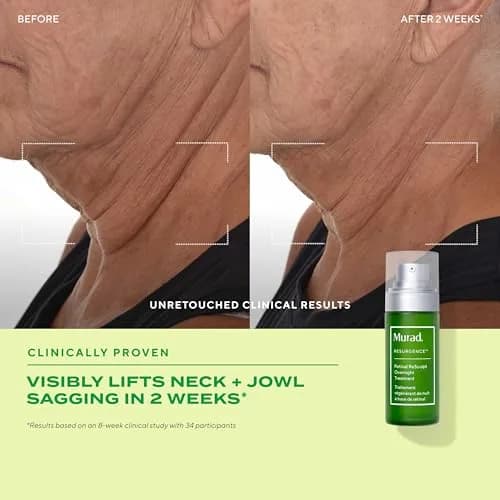Murad Retinal Trial Kit - Encapsulated Retinal - 2-pc Set | Anti-Aging for Lines & Wrinkles thumbnail 3