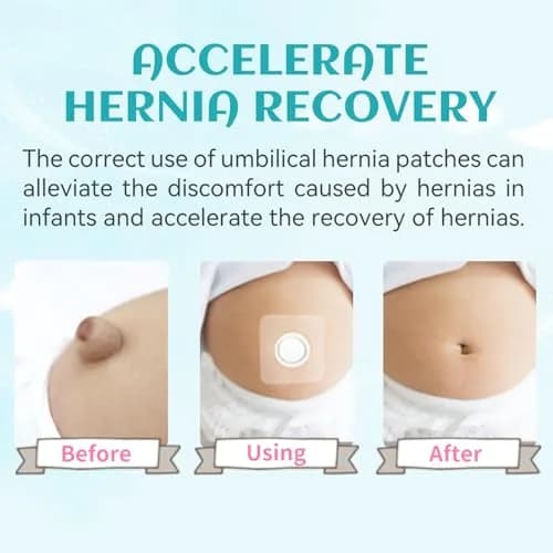 ENLUNTRA Belly Button Shaper Waterproof Cotton Pads 10×10cm | Infant Navel Support thumbnail 3