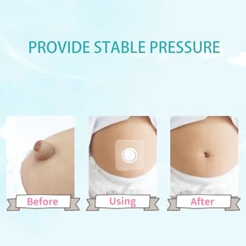 ENLUNTRA Belly Button Shaper with Waterproof Cotton Pads 8×8cm | Infant Navel Support for Baby's Comfort thumbnail 6