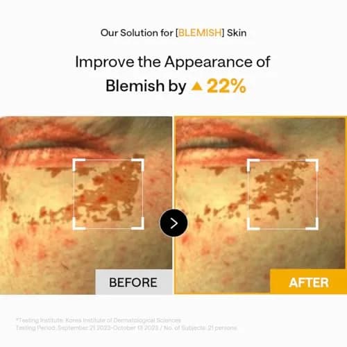 MEDIHEAL Vitamin & Collagen Under Eye Patches 60 Count | Targets Wrinkles, Dark Spots & Blemishes thumbnail 5