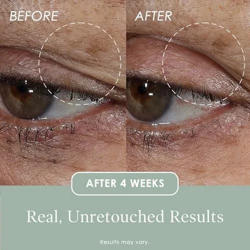 Crepe Erase Lift & Smooth Eyelid Treatment 0.77 FL Oz | Anti-Aging Serum for Eyes thumbnail 5