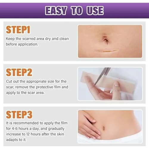 PSECICI Silicone Scar Sheets 1.5m (59") Beige | Medical Grade Scar Tape for Old & New Scars thumbnail 8