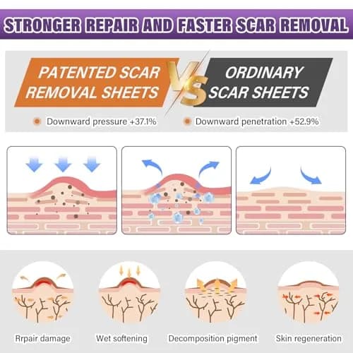 PSECICI Silicone Scar Sheets 1.5m (59") Beige | Medical Grade Scar Tape for Old & New Scars thumbnail 3