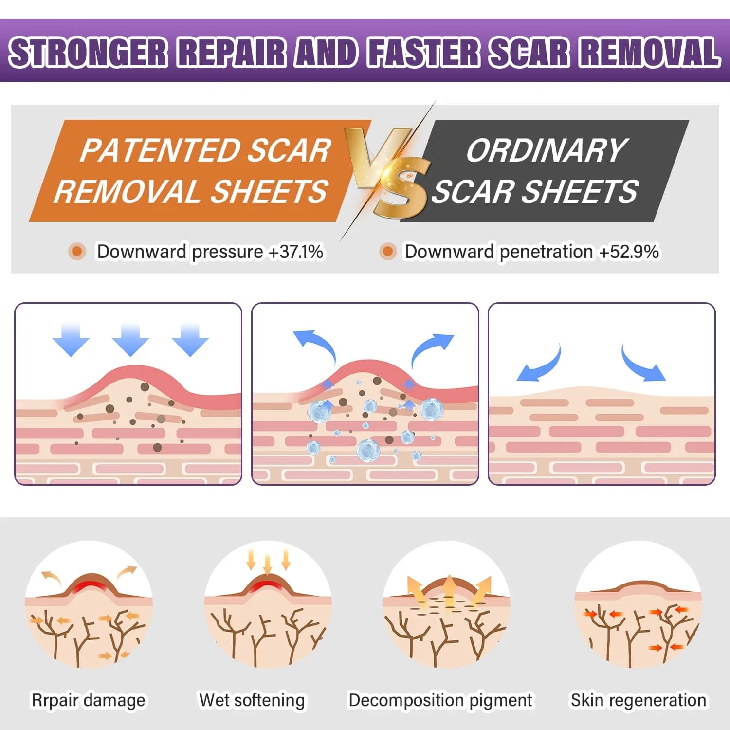 PSECICI Silicone Scar Sheets 1.5m (59") Beige | Medical Grade Scar Tape for Old & New Scars - view 3