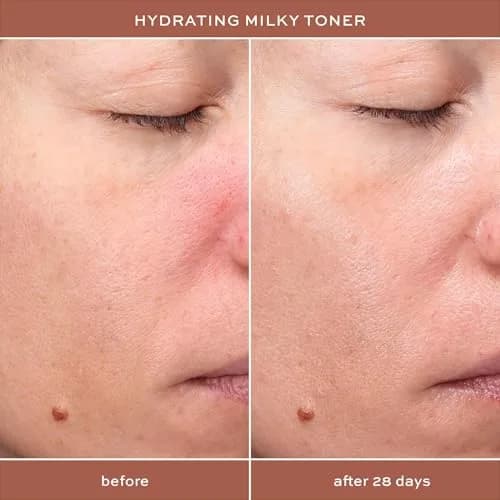 I.T.K. Glowy Skin 3-Step Routine - Hyaluronic Acid + Niacinamide Serum, Squalane Toner, Deep Moisture Ceramide Face Cream | Hydrating & Radiant thumbnail 6
