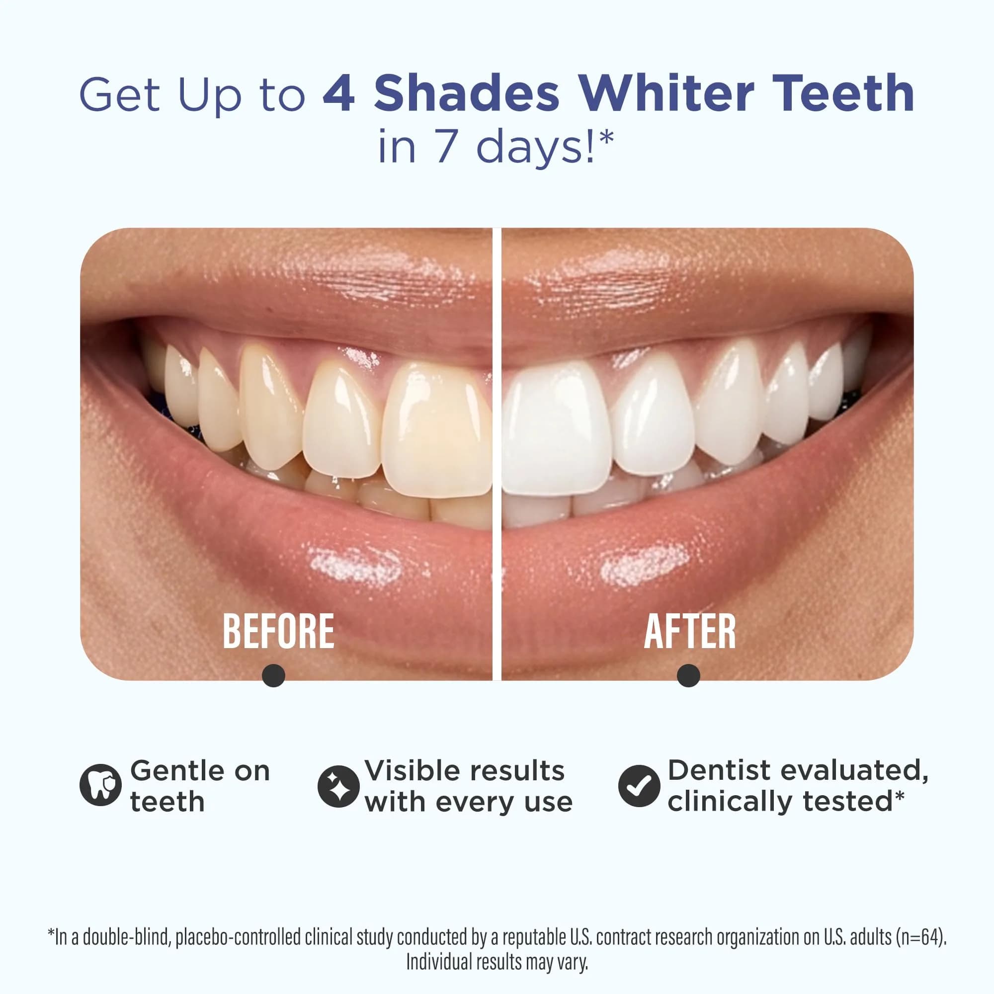 GuruNanda Teeth Whitening Strips Kit 32 Count (Pack of 1) | Hydrogen Peroxide & Coconut Oil for Brighter Smile - view 2
