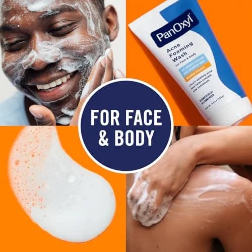 PanOxyl Acne Foaming Wash 10% Benzoyl Peroxide 85g (3 oz) | Kills Acne Bacteria on Contact thumbnail 5
