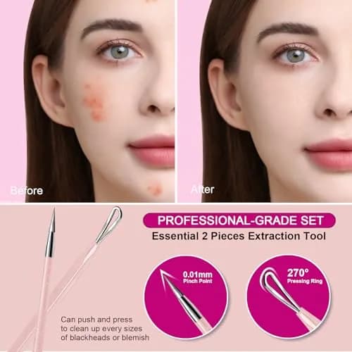 Teenitor Blackhead & Blemish Remover Kit | 2-in-1 Stainless Steel Tools for Face, Pink thumbnail 6
