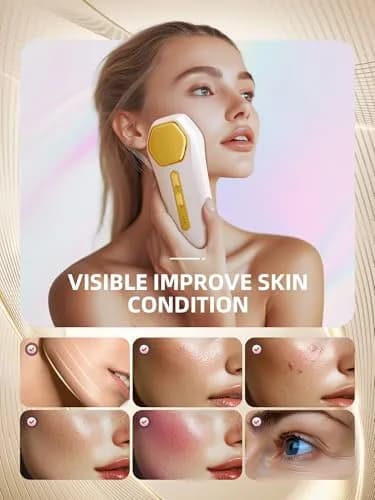 INTEO Microcurrent Facial Machine 2328 | Skin Glow & Anti-Aging (120 chars) thumbnail 4