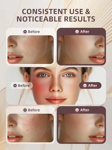 INTEO Microcurrent Facial Machine 2328 | Skin Glow & Anti-Aging (120 chars) thumbnail 3