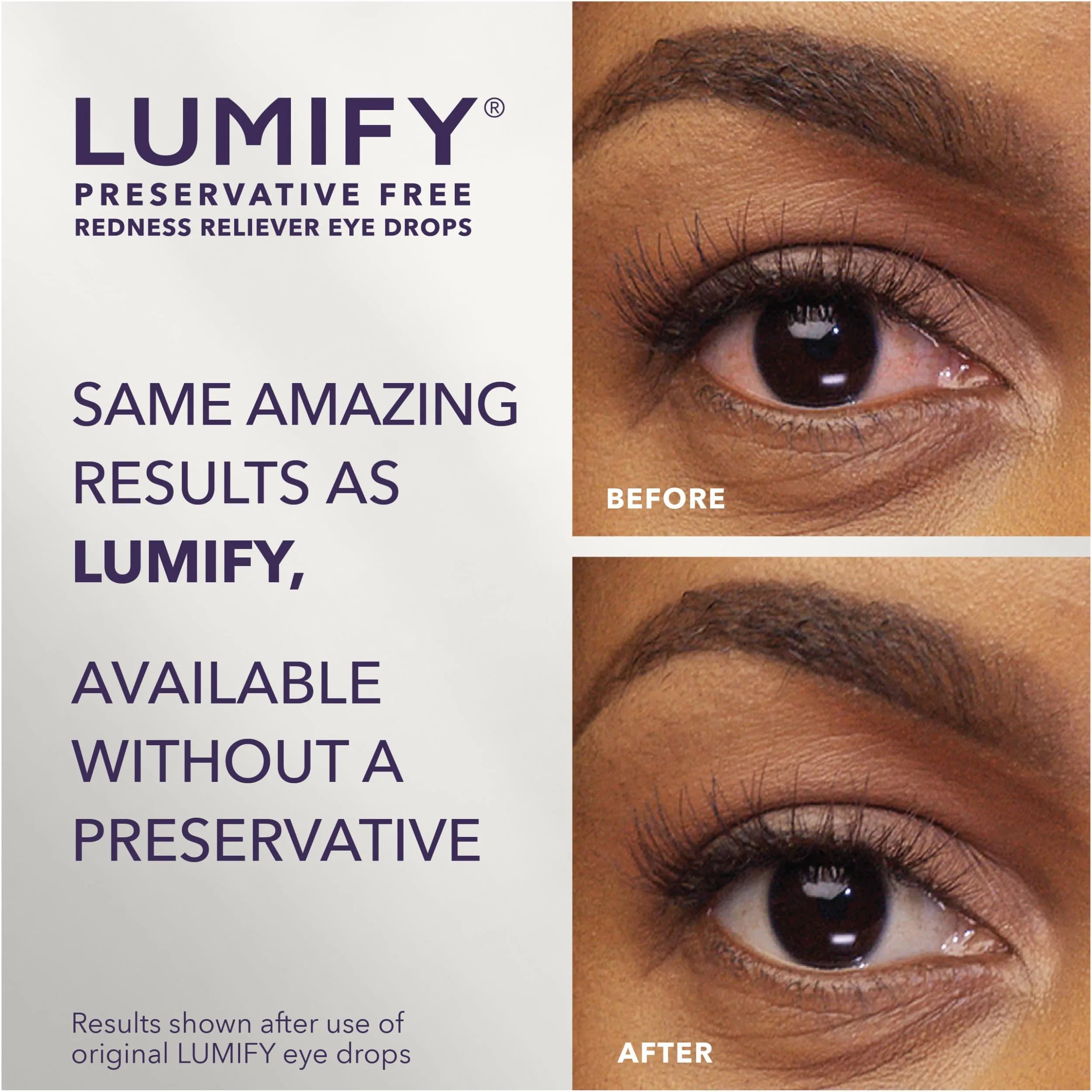 LUMIFY Preservative Free Eye Drops Redness Relief, Sensitive Eyes, 20 Single-Use Vials | Gentle & Effective Redness Relief - view 2