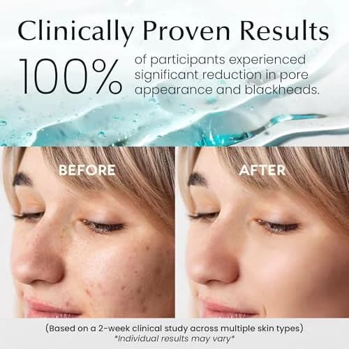 LA PURE Korean Toner Pads for Face, Dark Spots & Dull Skin – 100 Count | Hydrating, Exfoliating, Brightening thumbnail 5