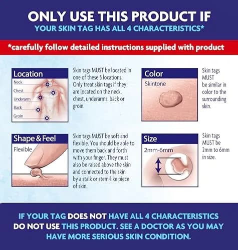 Alocane Skin Tag Removal Kit with 12 Precision Applicators | FDA-Cleared Cryotherapy for Safe Home Use thumbnail 5